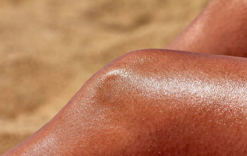 Sunburn treatment Bali